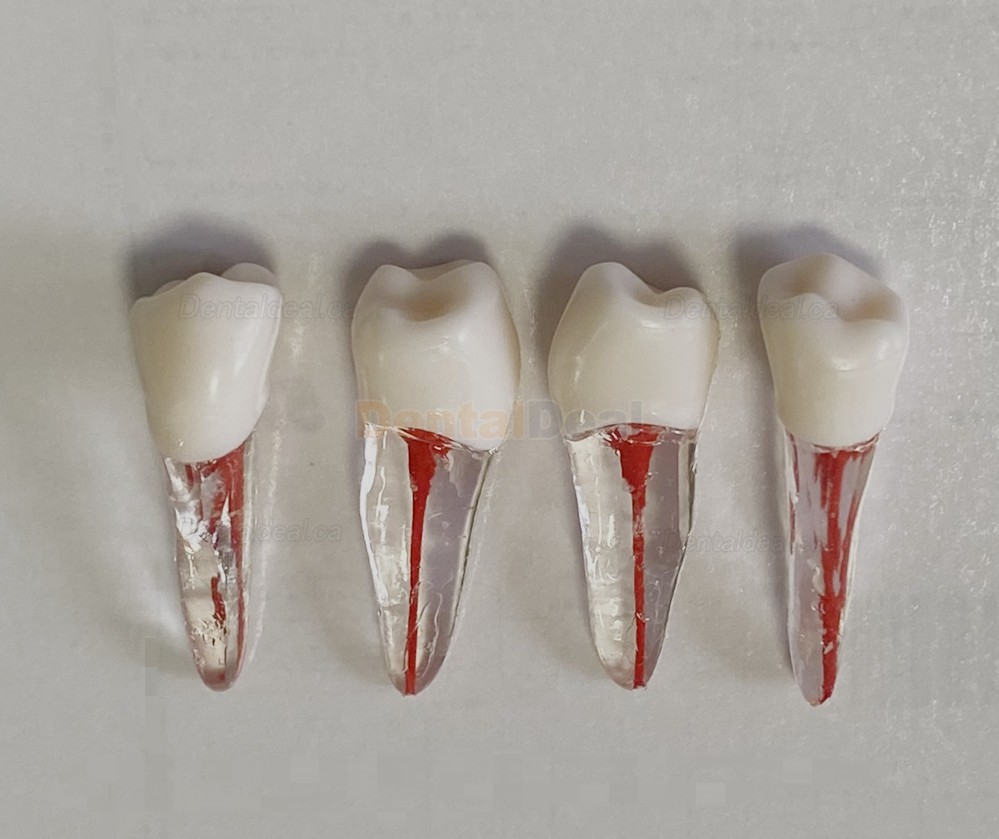 Dental Teeth Practice Model Endo File Molar Upper Lower Tooth Premolar Root 2/3-Rooted Canal